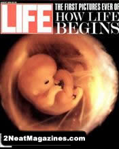 Life Magazine fetal image